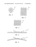 COLLAPSIBLE/EXPANDABLE TUBULAR ELECTRODE LEADS diagram and image