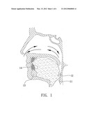 ANTISNORING DEVICE diagram and image