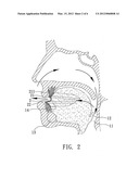 ANTISNORING DEVICE diagram and image