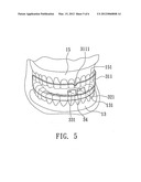 ANTISNORING DEVICE diagram and image