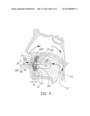 ANTISNORING DEVICE diagram and image