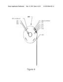 Multi-Positional Articulating Hinge with Internal Stops and Remote     Actuation and Methods for Manufacturing the Same diagram and image