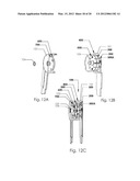 Multi-Positional Articulating Hinge with Internal Stops and Remote     Actuation and Methods for Manufacturing the Same diagram and image