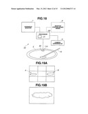 Medical apparatus diagram and image