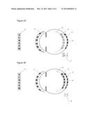 METHOD AND SYSTEM FOR RETARDING THE PROGRESSION OF MYOPIA diagram and image