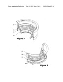 Tensioned Adjustment Mechanism for Mounted Loudspeaker System diagram and image