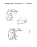 Tensioned Adjustment Mechanism for Mounted Loudspeaker System diagram and image