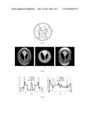 EXACT LOCAL COMPUTED TOMOGRAPHY BASED ON COMPRESSIVE SAMPLING diagram and image