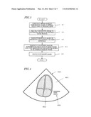 ULTRASONIC DIAGNOSTIC DEVICE diagram and image