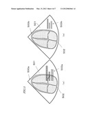 ULTRASONIC DIAGNOSTIC DEVICE diagram and image