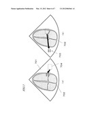 ULTRASONIC DIAGNOSTIC DEVICE diagram and image