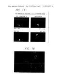 PSCA: PROSTATE STEM CELL ANTIGEN AND USES THEREOF diagram and image