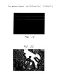 PSCA: PROSTATE STEM CELL ANTIGEN AND USES THEREOF diagram and image