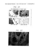 PSCA: PROSTATE STEM CELL ANTIGEN AND USES THEREOF diagram and image