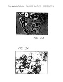 PSCA: PROSTATE STEM CELL ANTIGEN AND USES THEREOF diagram and image