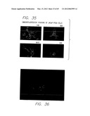 PSCA: PROSTATE STEM CELL ANTIGEN AND USES THEREOF diagram and image