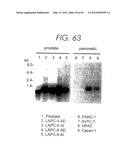 PSCA: PROSTATE STEM CELL ANTIGEN AND USES THEREOF diagram and image