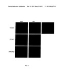 Methods For Treating Diseases and HCV Using Antibodies To     Aminophospholipids diagram and image