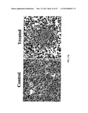 Methods For Treating Diseases and HCV Using Antibodies To     Aminophospholipids diagram and image