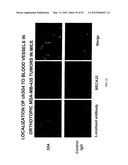 Methods For Treating Diseases and HCV Using Antibodies To     Aminophospholipids diagram and image