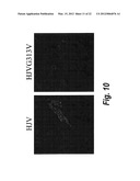 METHODS AND COMPOSITION TO REGULATE IRON METABOLISM diagram and image