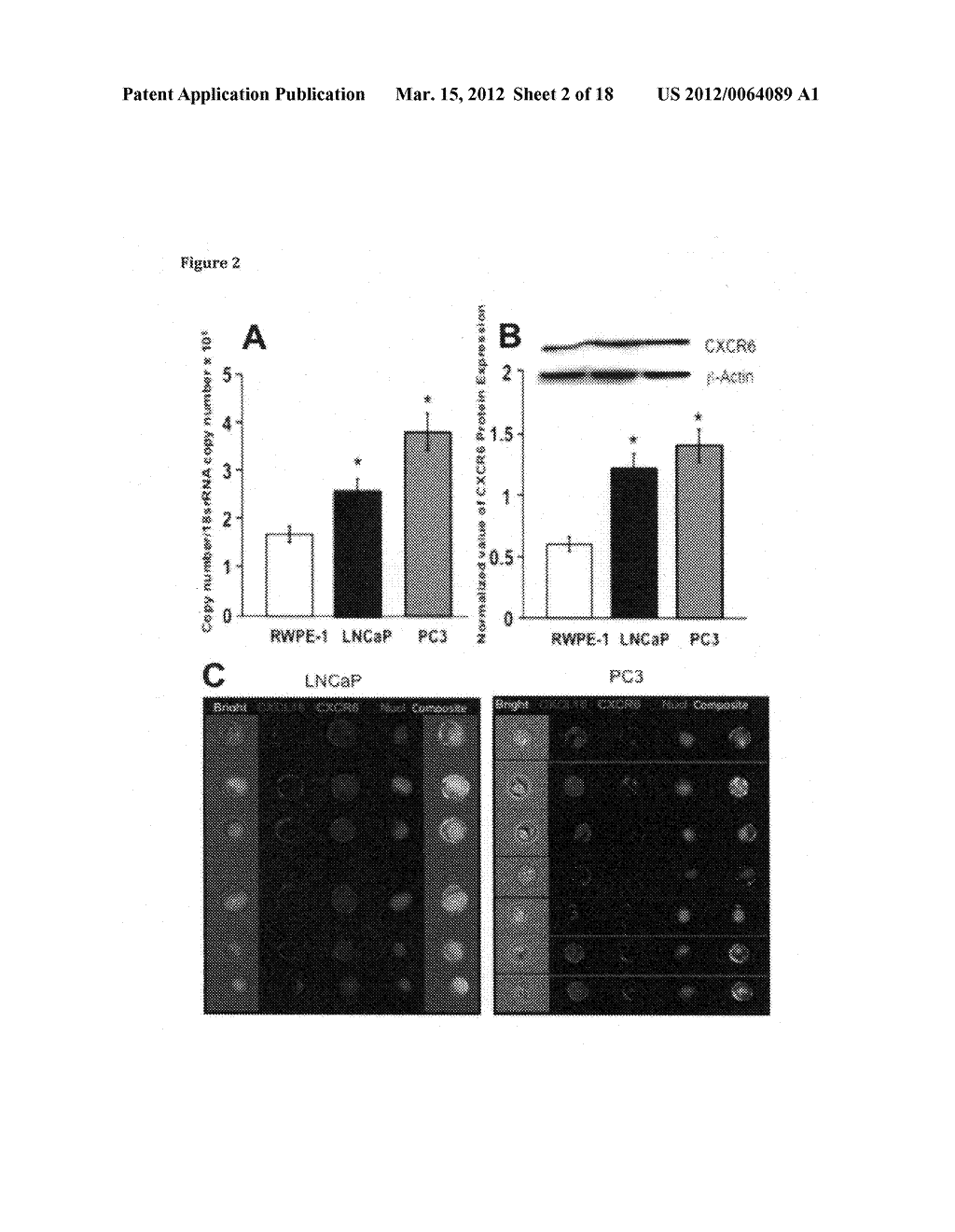 ANTI-CXCL16 AND ANTI-CXCR6 ANTIBODIES FOR THE PREVENTION AND TREATMENT OF     CANCER AND CANCER CELL MIGRATION - diagram, schematic, and image 03