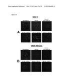 ANTI-CXCL16 AND ANTI-CXCR6 ANTIBODIES FOR THE PREVENTION AND TREATMENT OF     CANCER AND CANCER CELL MIGRATION diagram and image