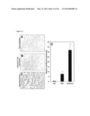 ANTI-CXCL16 AND ANTI-CXCR6 ANTIBODIES FOR THE PREVENTION AND TREATMENT OF     CANCER AND CANCER CELL MIGRATION diagram and image