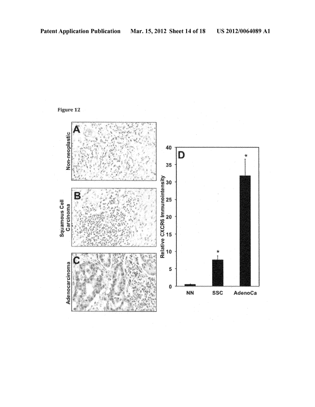 ANTI-CXCL16 AND ANTI-CXCR6 ANTIBODIES FOR THE PREVENTION AND TREATMENT OF     CANCER AND CANCER CELL MIGRATION - diagram, schematic, and image 15