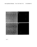 ANTIBODY diagram and image