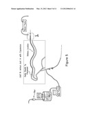 Drug-Coated Balloon With Location-Specific Plasma Treatment diagram and image