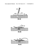 Hydrogel Implants with Varying Degrees of Crosslinking diagram and image