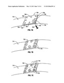 Hydrogel Implants with Varying Degrees of Crosslinking diagram and image