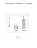 Use of Serum Amyloid A Gene in Diagnosis and Treatment of Glaucoma and     Identification of Anti-Glaucoma Agents diagram and image