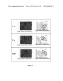 BIOMARKERS FOR DIAGNOSIS OF STROKE AND ITS CAUSES diagram and image