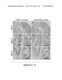 METHOD OF PREDICTING CHEMOTHERAPY EFFECTIVENESS IN COLON ADENOCARCINOMA     PATIENTS, USING MIR-21 diagram and image