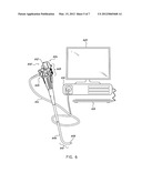 MULTI-VIEWING ELEMENT ENDOSCOPE diagram and image