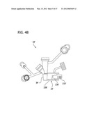 CATHETER WITH IMAGING ASSEMBLY diagram and image