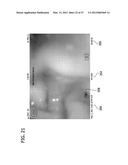 CATHETER WITH IMAGING ASSEMBLY diagram and image