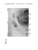 CATHETER WITH IMAGING ASSEMBLY diagram and image