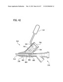 CATHETER WITH IMAGING ASSEMBLY diagram and image