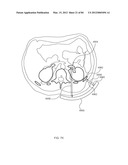 ENERGETIC MODULATION OF NERVES diagram and image