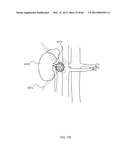 ENERGETIC MODULATION OF NERVES diagram and image