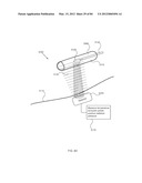 ENERGETIC MODULATION OF NERVES diagram and image