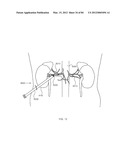 ENERGETIC MODULATION OF NERVES diagram and image