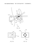 ENERGETIC MODULATION OF NERVES diagram and image