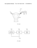 ENERGETIC MODULATION OF NERVES diagram and image