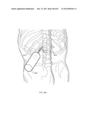 ENERGETIC MODULATION OF NERVES diagram and image