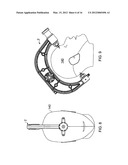 APPARATUS FOR IMAGING A BODY PART diagram and image