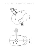 APPARATUS FOR IMAGING A BODY PART diagram and image